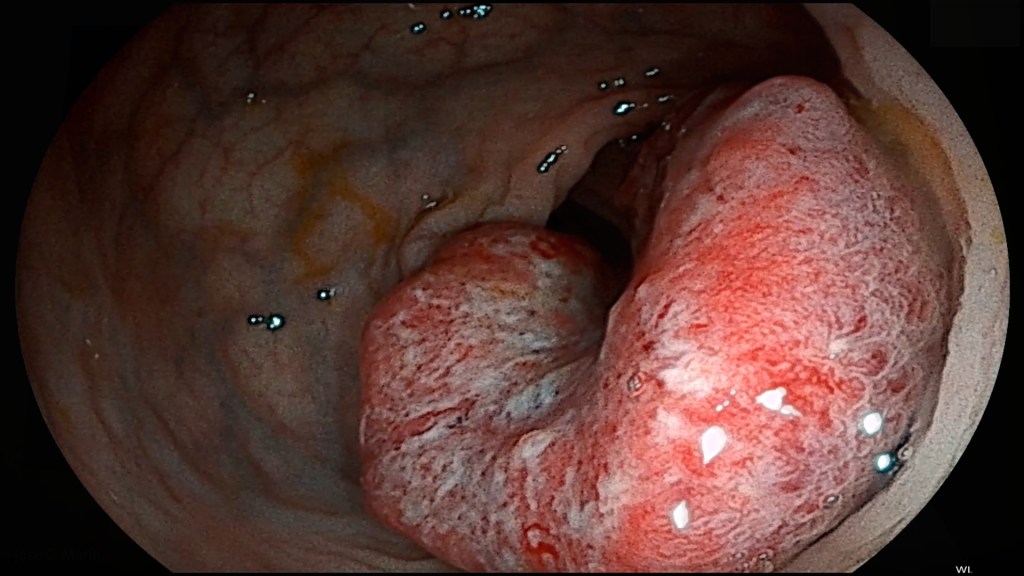 Mitos endoscopias digestivas