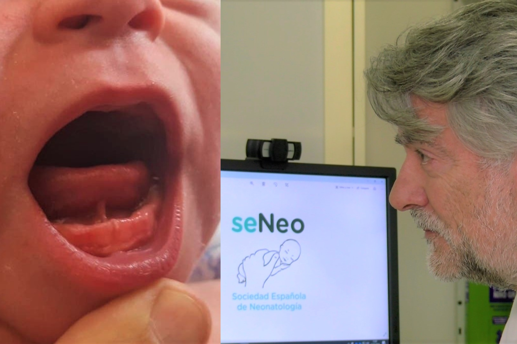 medidas antropométricas del desarrollo fetal y del bebé.