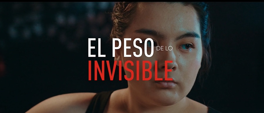 complicaciones, obesidad