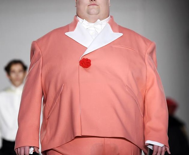 obesidad, complicaciones