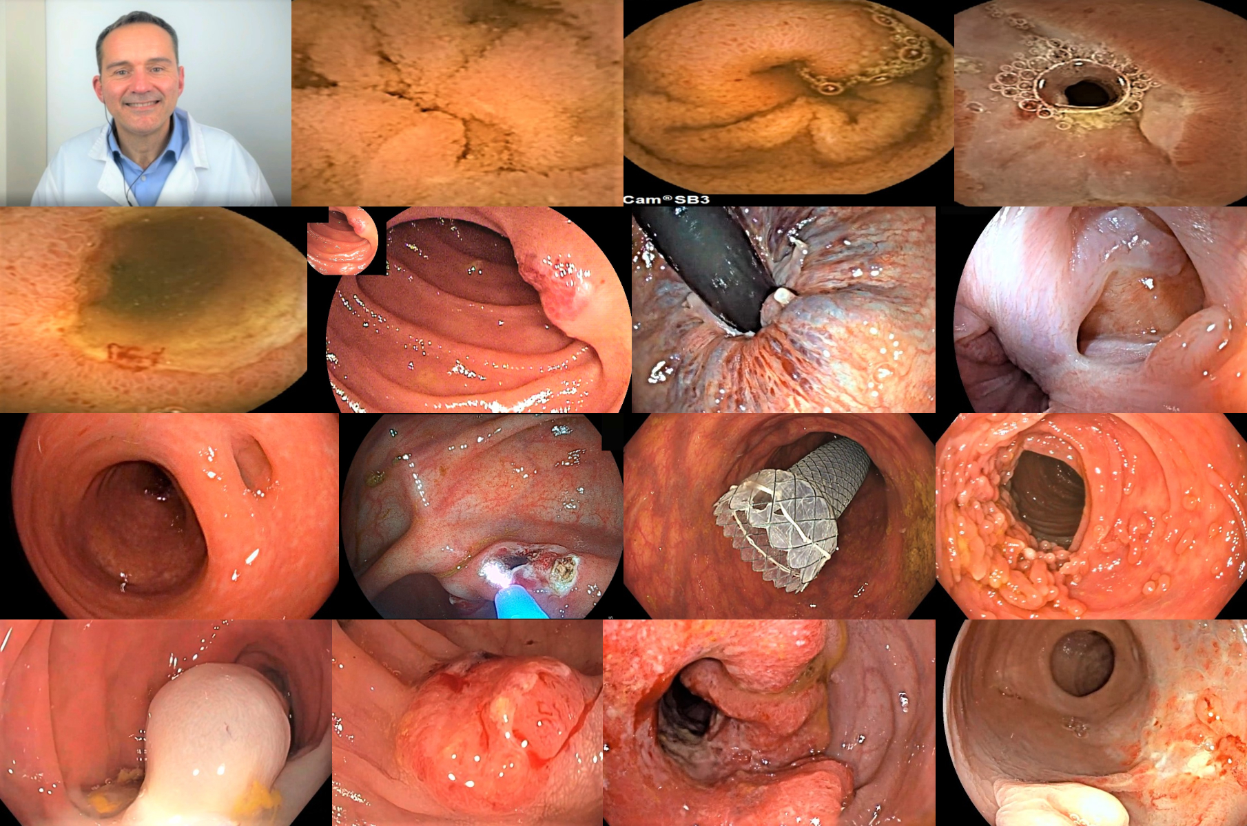 Tubo digestivo: yeyuno, íleon y colon.