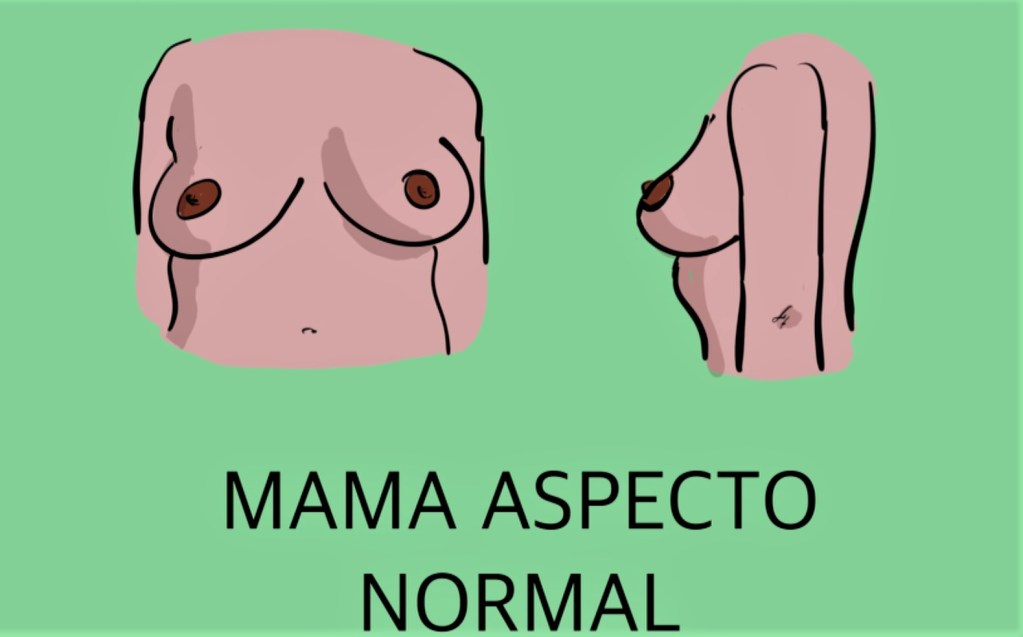 Mamas de aspecto normal.
