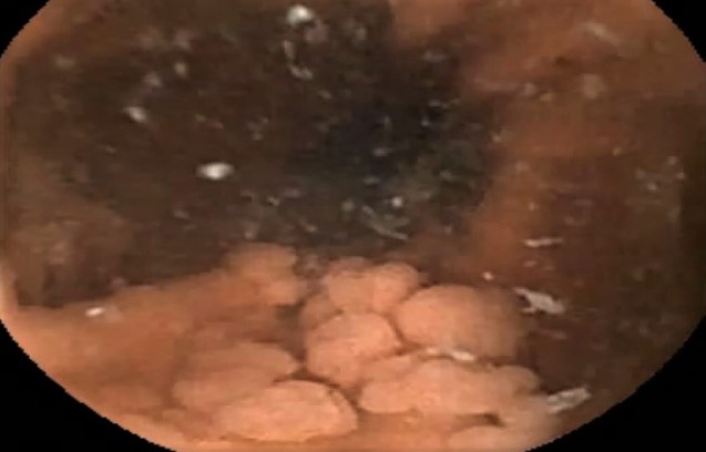 Tubo digestivo: yeyuno, íleon y colon.