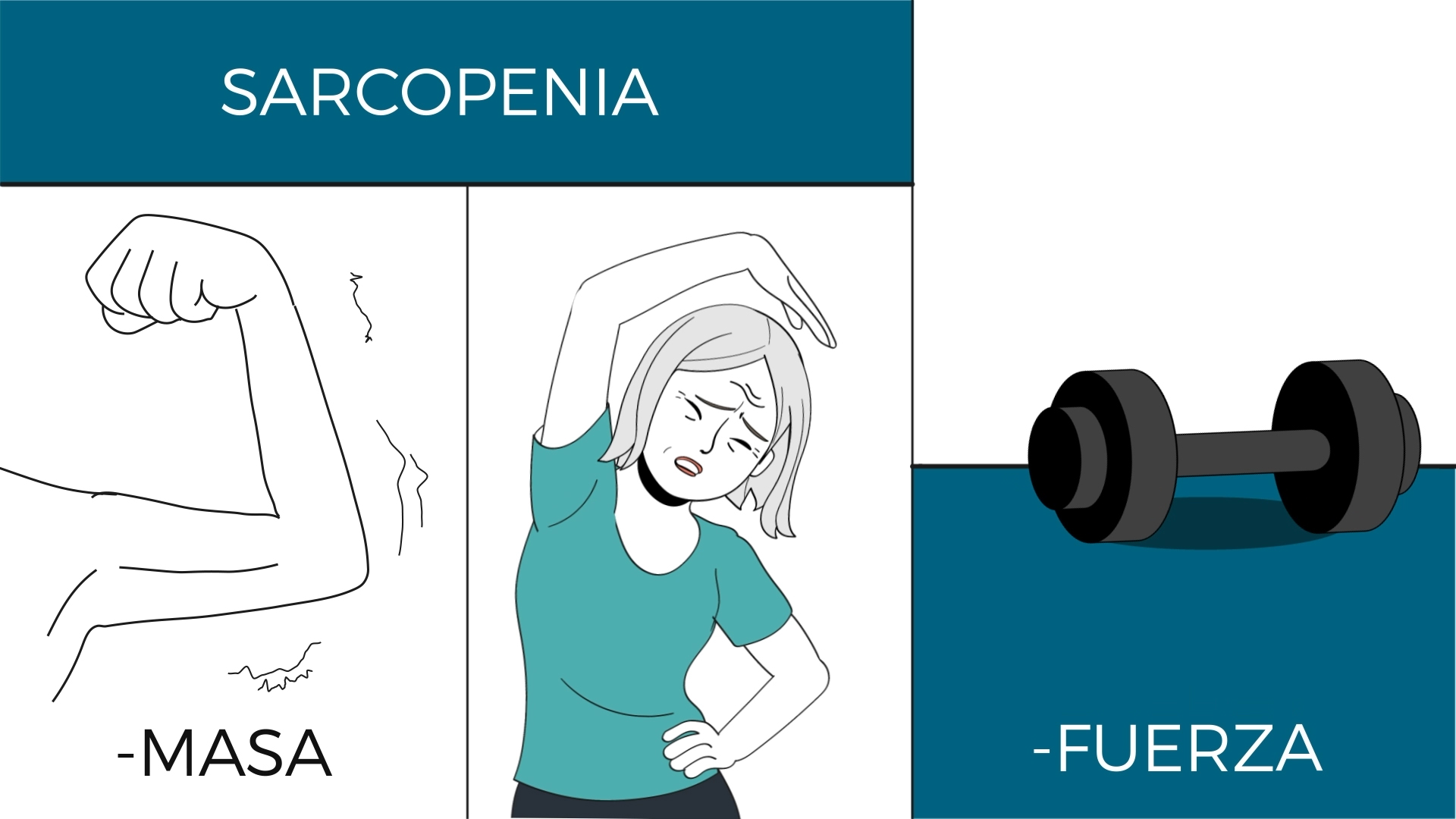 sarcopenia mayores
