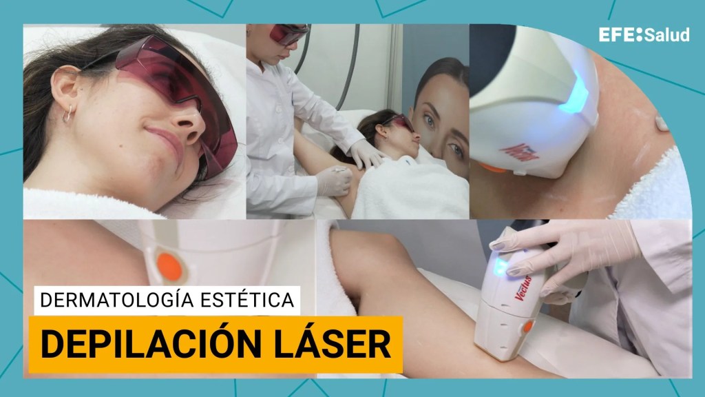 Depilación láser.