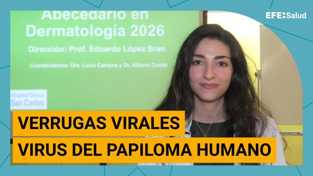 Verrugas víricas.