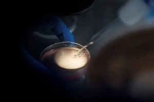tratamientos fertilidad