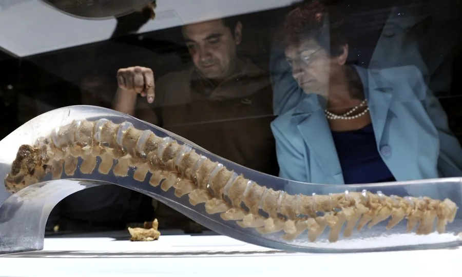 osteoporosis secundaria 